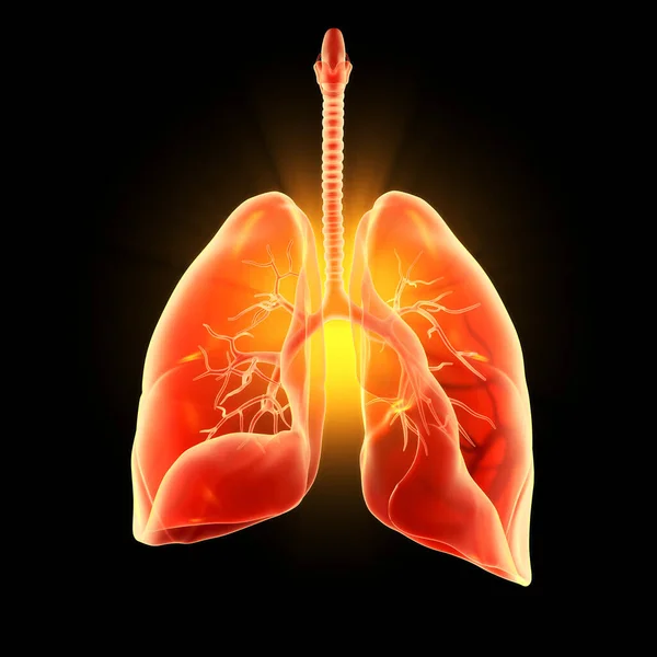 Ilustración Que Muestra Pulmones Humanos Resaltados Neumonía Ilustración —  Fotos de Stock