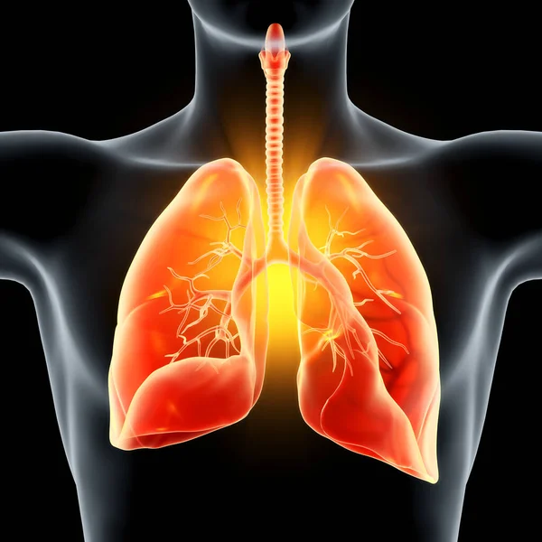 感染した肺を示す3Dイラスト — ストック写真