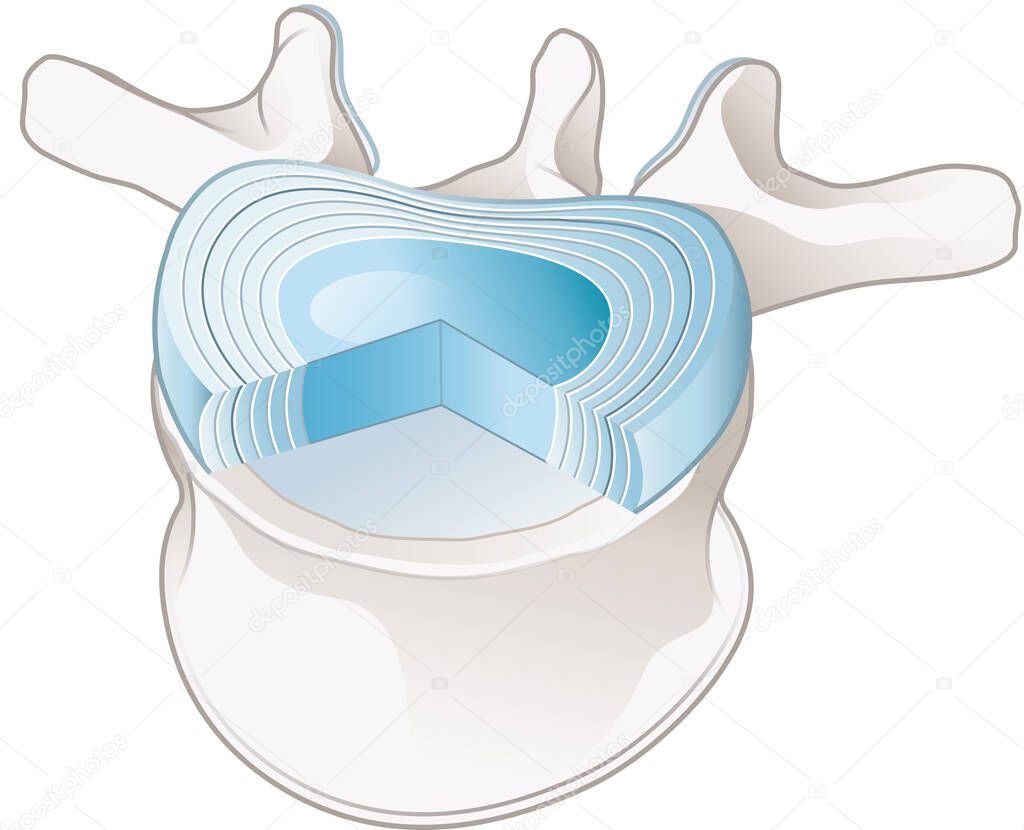 Illustration showing healthy lumbar vertebrae and intervertebral disc. Labeled illustration
