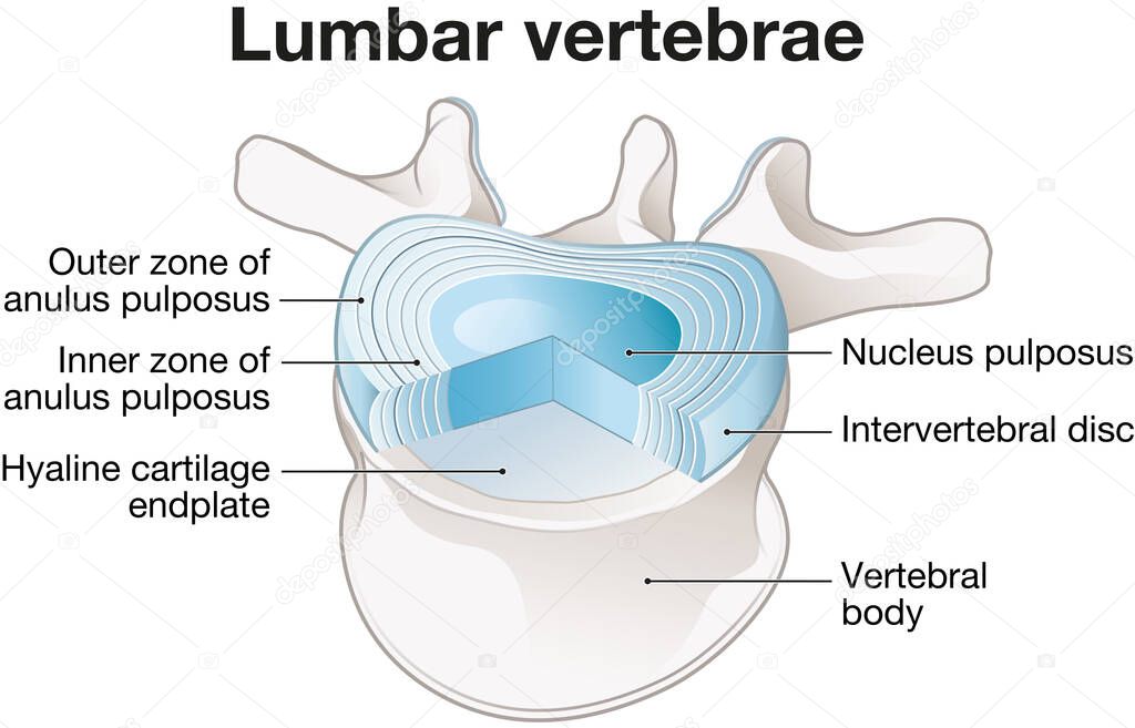Illustration showing healthy lumbar vertebrae and intervertebral disc. Labeled illustration
