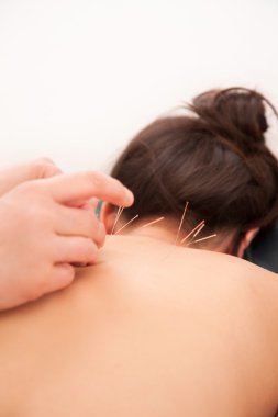 Acupuncture in the neck clipart
