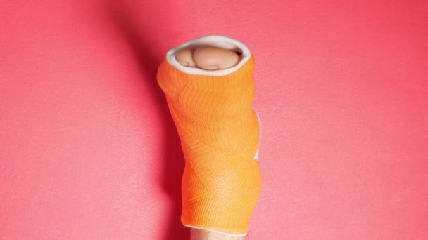 脚趾骨骨折 橙色玻璃纤维铸粉红色背景 人工热塑性玻璃布制成的现代骨科防水铸件损伤性腿肿肿4K — 图库视频影像