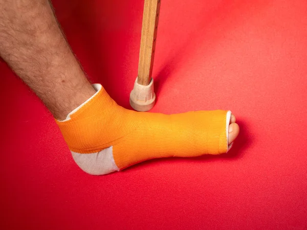 Foot with broken toe bone in orange fiberglass cast pink background. Injured fractured swollen male leg in modern orthopedic waterproof cast made of synthetic thermoplastic glass cloth. Patient body.