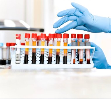 Biyolojik madde test tüplerinde. Eldivenli laboratuvar asistanının elleri.