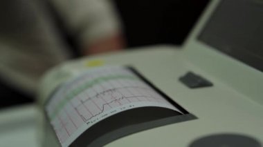 Elektronik Kardiyografi Makinesi rahmin fetal kalp kasılmalarını izliyor. Hamilelik sırasında doğum koğuşunda elektrokardiyogram çıktı. Tıbbi Teşhis Ekipmanı