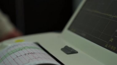 Elektronik Kardiyografi Makinesi rahmin fetal kalp kasılmalarını izliyor. Hamilelik sırasında doğum koğuşunda elektrokardiyogram çıktı. Tıbbi Teşhis Ekipmanı