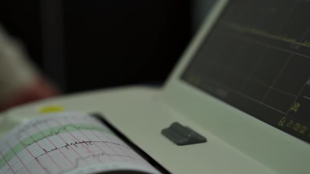 Електронна кардіотокографічна машина для моніторингу фетрових серцевих скорочень Утера. Друк кардіограми Доповідь, що виходить з електрокардіограми в трудовій палаті під час вагітності. Медичне діагностичне обладнання — стокове відео