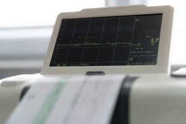 Elektronik Kardiyografi Makinesi rahmin fetal kalp kasılmalarını izliyor. Hamilelik sırasında doğum koğuşunda elektrokardiyogram çıktı. Tıbbi Teşhis Ekipmanı