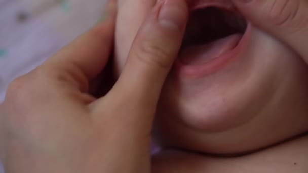 医学小児科歯科新生児の痛みの概念です。腫れた歯茎から最初のミルクの赤ちゃんの歯の涙を開く。口腔開腹歯科検査で笑顔の超クローズアップポートレート — ストック動画