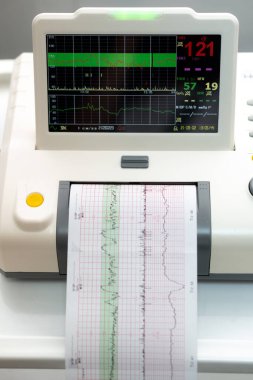 Elektronik Kardiyografi Makinesi rahmin fetal kalp kasılmalarını izliyor. Hamilelik sırasında doğum koğuşunda elektrokardiyogram çıktı. Tıbbi Teşhis Ekipmanı