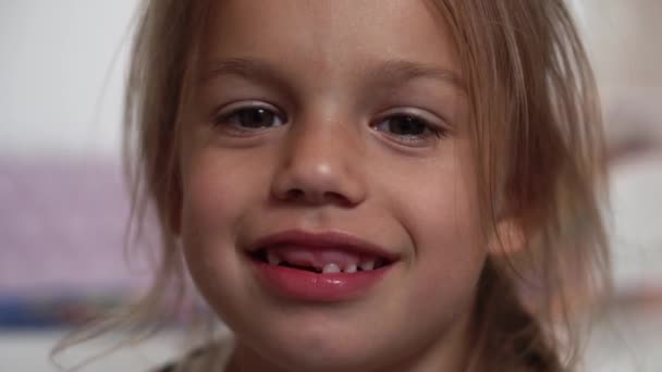 Κοντινό Χαμόγελο Του Κοριτσιού Ένα Όμορφο Κοριτσάκι Ετών Έχασε Δόντια — Αρχείο Βίντεο