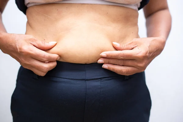 Женщины Держат Жир Большой Живот Белом Фоне Здоровой Концепции Питания — стоковое фото