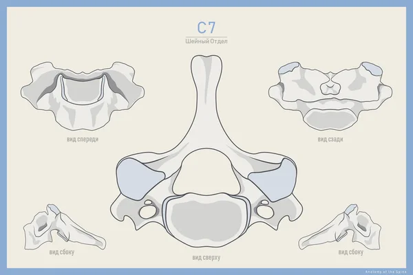 Anatomi Den Sjunde Cervical Vertebra Ryska Vertebra Prominens Illustration För — Stock vektor