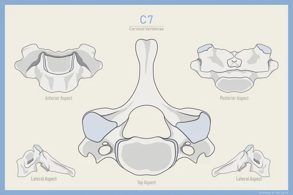 Anatomy 7Th Cervical Vertebra Vertebra Prominens Anterior Posterior Lateral Top — Stock Vector