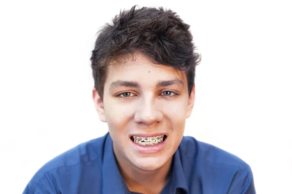 Teenager Sad Face Braces Teeth Blue Shirt White Background Copy —  Fotos de Stock