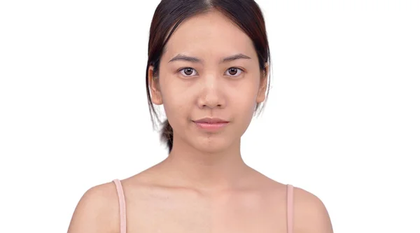 Comparison Face Beautiful Asian Young Woman Make Development Skin Repairing — Fotografia de Stock