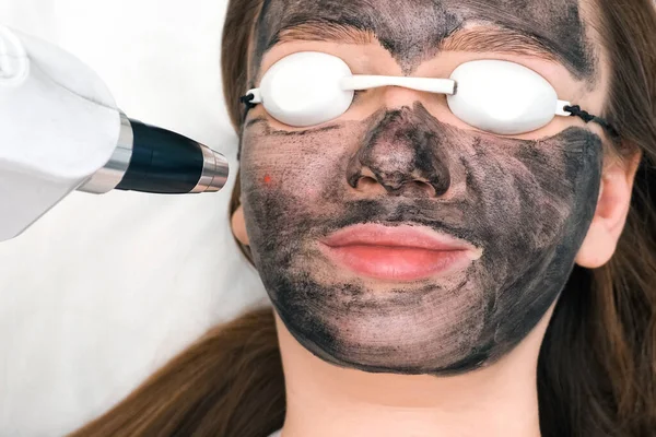 Carbon peeling of the face of a young beautiful woman. Peeling skin renewal. laser point on the face.