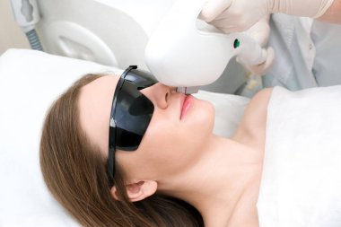 Genç ve güzel bir kadının bıyığının ve çenesinin lazerle çıkarılması. Yüzünde leke var. Lazer tüy temizleme aygıtı.