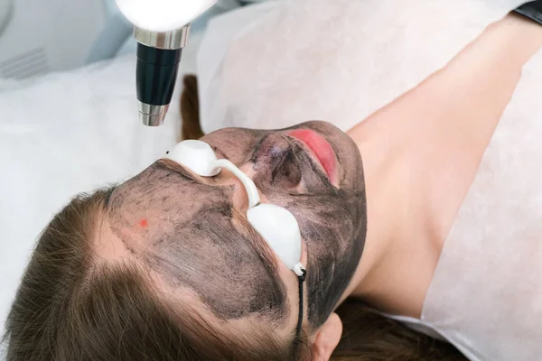 Carbon peeling of the face of a young beautiful woman. Peeling skin renewal. laser point on the face.