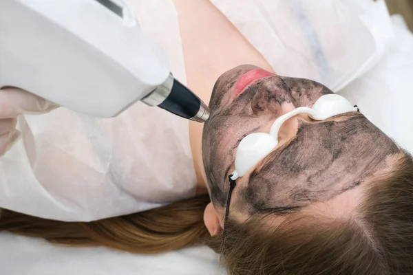 Peeling Węglowy Twarzy Młodej Pięknej Kobiety Odnowa Skóry Punkt Laserowy — Zdjęcie stockowe