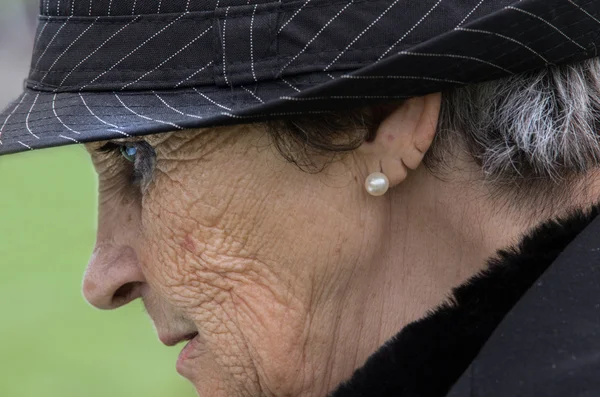 Signora con la pelle rugosa — Foto Stock