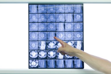 Bilgisayarlı Tomografi ve MR'da beynin seri