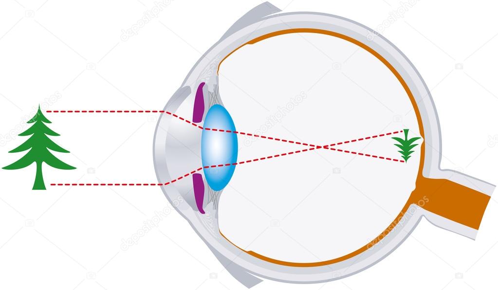 Vision, eyeball, optics, lens system