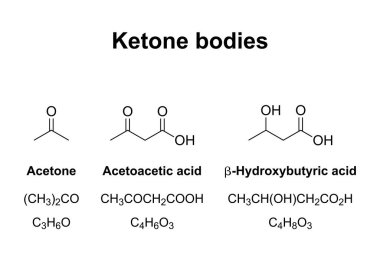 Ketone bodies, chemical formulas. Water-soluble molecules, that contain ketone groups, produced from fatty acids by the liver by ketogenesis. Acetone, Acetoacetic acid, and beta-Hydroxybutyric acid. clipart