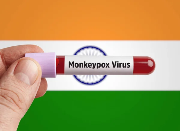 Concepto Del Virus Monkeypox Mpxv Científico Que Sostiene Sangre Infectada —  Fotos de Stock
