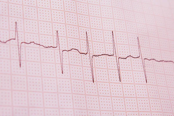 Cardiogram — Stock Photo, Image