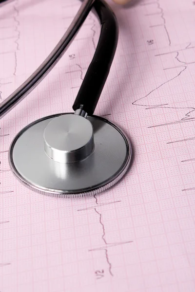 Cardiogram en stethoscoop — Stockfoto