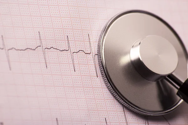 Cardiografía y estetoscopio —  Fotos de Stock