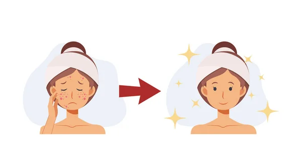Treat Acne Skin Problem Pimple Woman Face Beautyful Flat Vector — Stockvektor