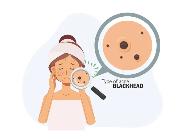 Trattare Acne Problema Della Pelle Pimple Woman Face Type Acne — Vettoriale Stock