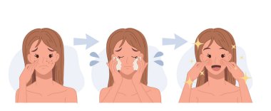 Sivilce tedavisi, deri sorunu, sivilce, kadın yüzü. Önce güzel, sonra da temizleyici yüz. Düz vektör 2d çizgi film karakteri çizimi. 