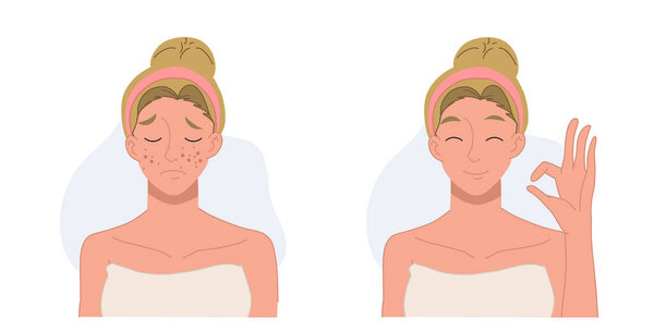 Skin care concept.woman,girl with acne.Before and after acne.Flat vector 2d cartoon character illustration.