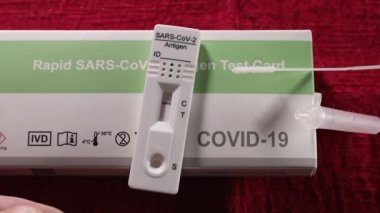 SARS-CoV-2 Antijen Testi negatif.
