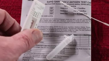 SARS-CoV-2 Antijen Testi negatif.