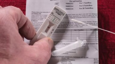 SARS-CoV-2 Antijen Testi negatif.