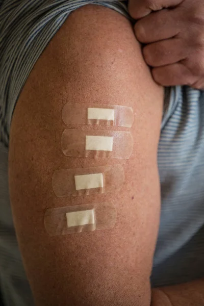 Brazo Hombre Con Cuatro Tiritas Que Representan Cuatro Inoculaciones Incluyendo — Foto de Stock