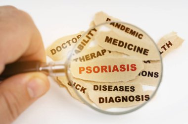 Tıbbi konsept. Bir adam büyüteçle tıbbi yazıtların olduğu kağıt parçalarına bakar, ortasında kırmızı bir yazı vardır - PSORIASIS