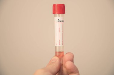 Coronavirus, 2019-nCoV, SARS-nCov, COVID-19 'a karşı aşı ile test tüpü.