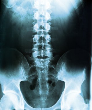 insan vücudu üzerinde x-ray