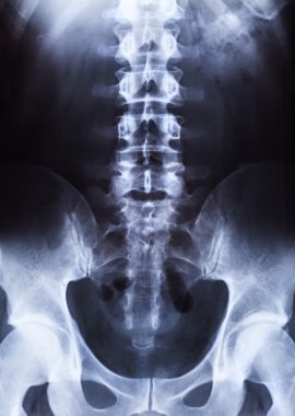 insan vücudu üzerinde xray