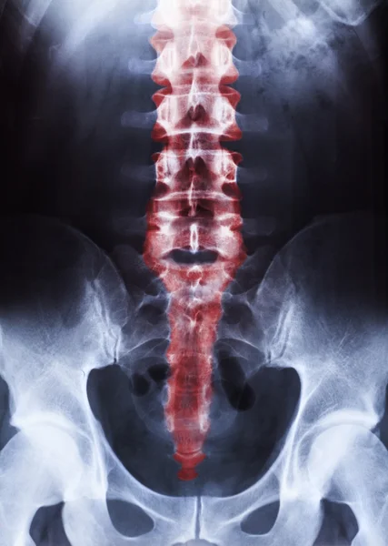 Insan vücudu üzerinde xray — Stok fotoğraf