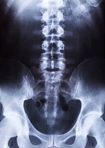 Insan vücudu üzerinde xray — Stok fotoğraf