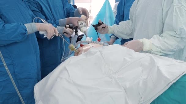 The surgeon holds special medical instruments in his hands during the operation. — Stock Video