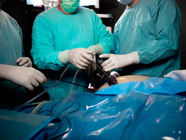 Hænder af kirurger i sterile handsker under en operation. - Stock-foto