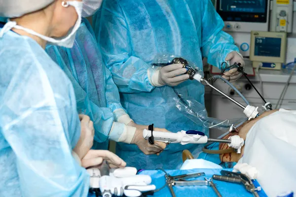 Mãos de cirurgiões com manipuladores cirúrgicos laparoscópicos — Fotografia de Stock