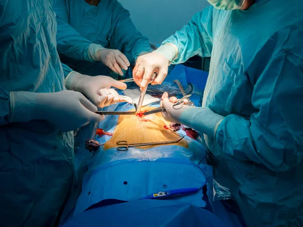 A sebész egy sebészeti eszközt helyez a beteg testébe.. — Stock Fotó